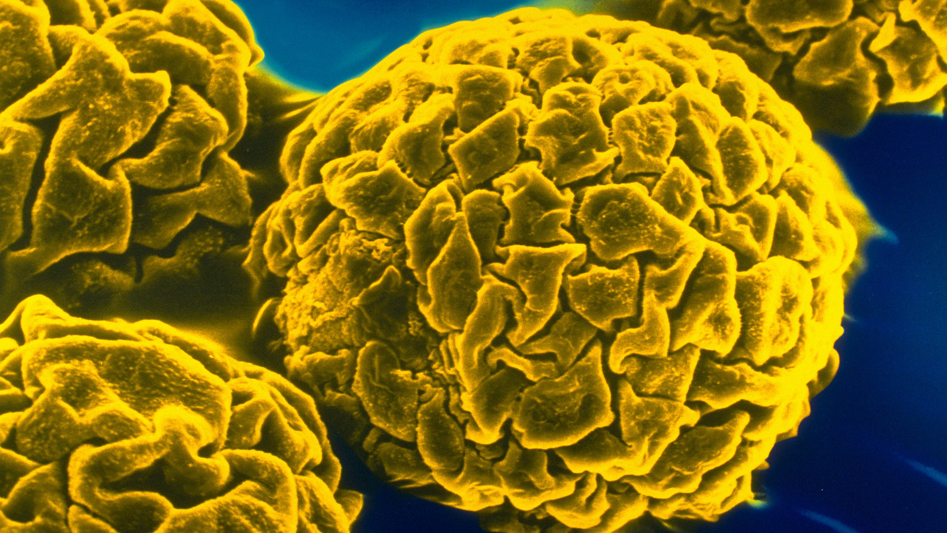 Информационный материал о заболеваемости желтой лихорадкой в мире и мерах профилактики