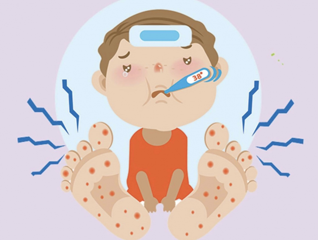 Энтеровирусная инфекция, профилактика