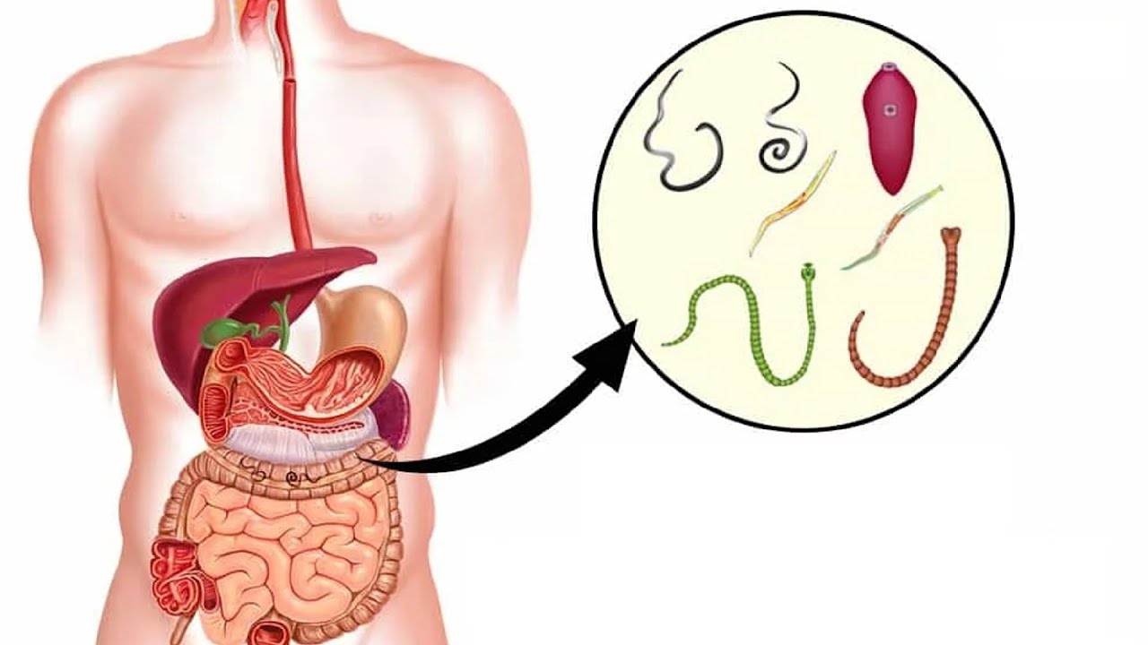 Паразиты в организме. Пути решения проблемы