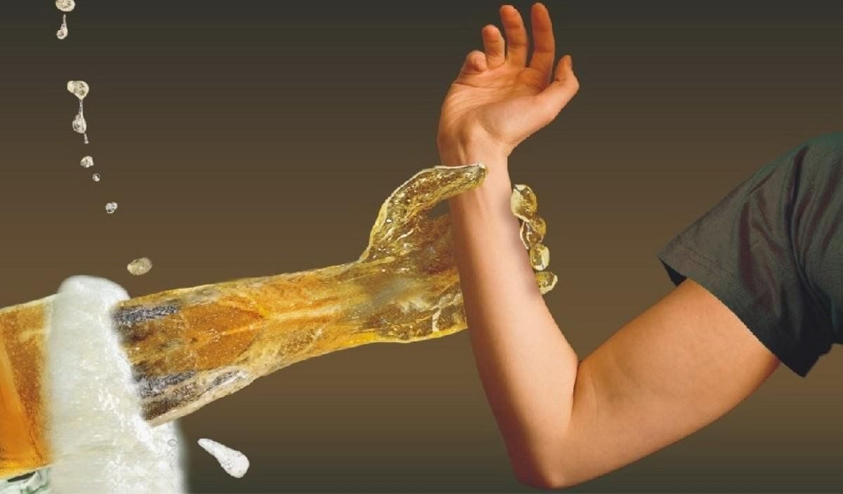 Пивной алкоголизм